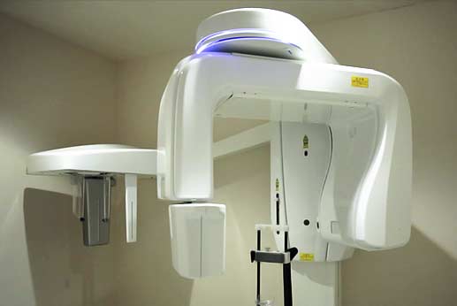 歯科用ＣＴ